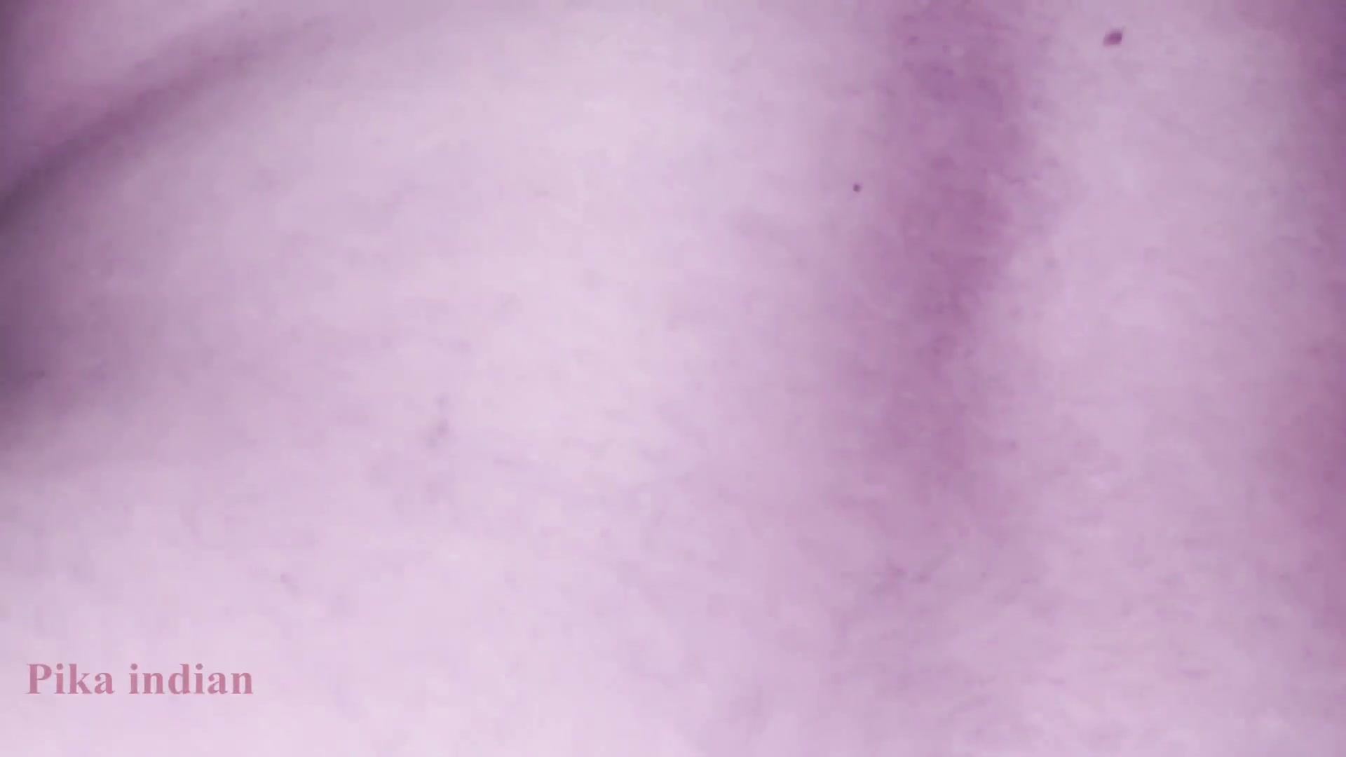 Frame 6