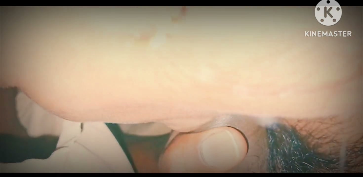 Frame 6