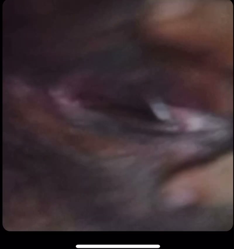 Frame 2