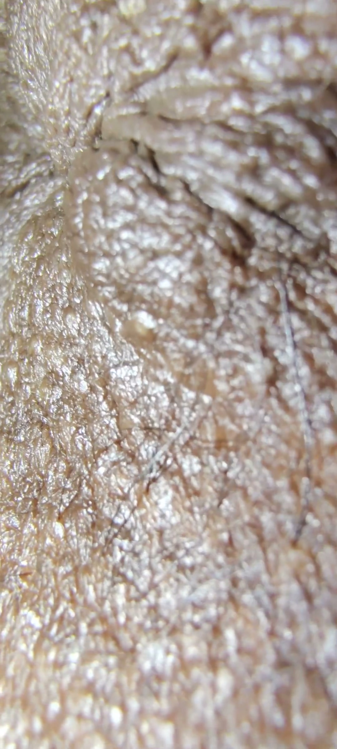 Frame 7