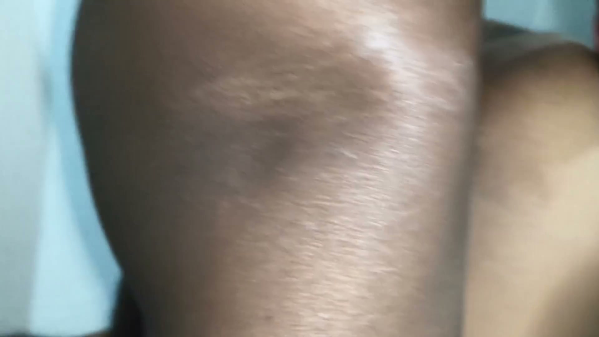 Frame 10