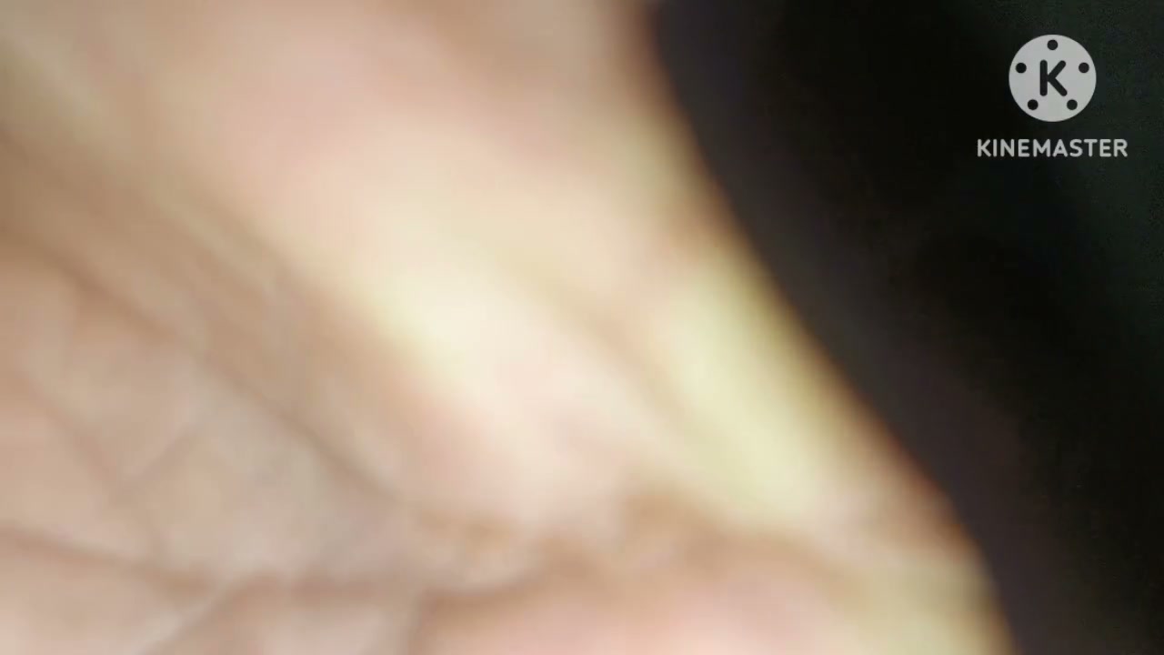 Frame 2