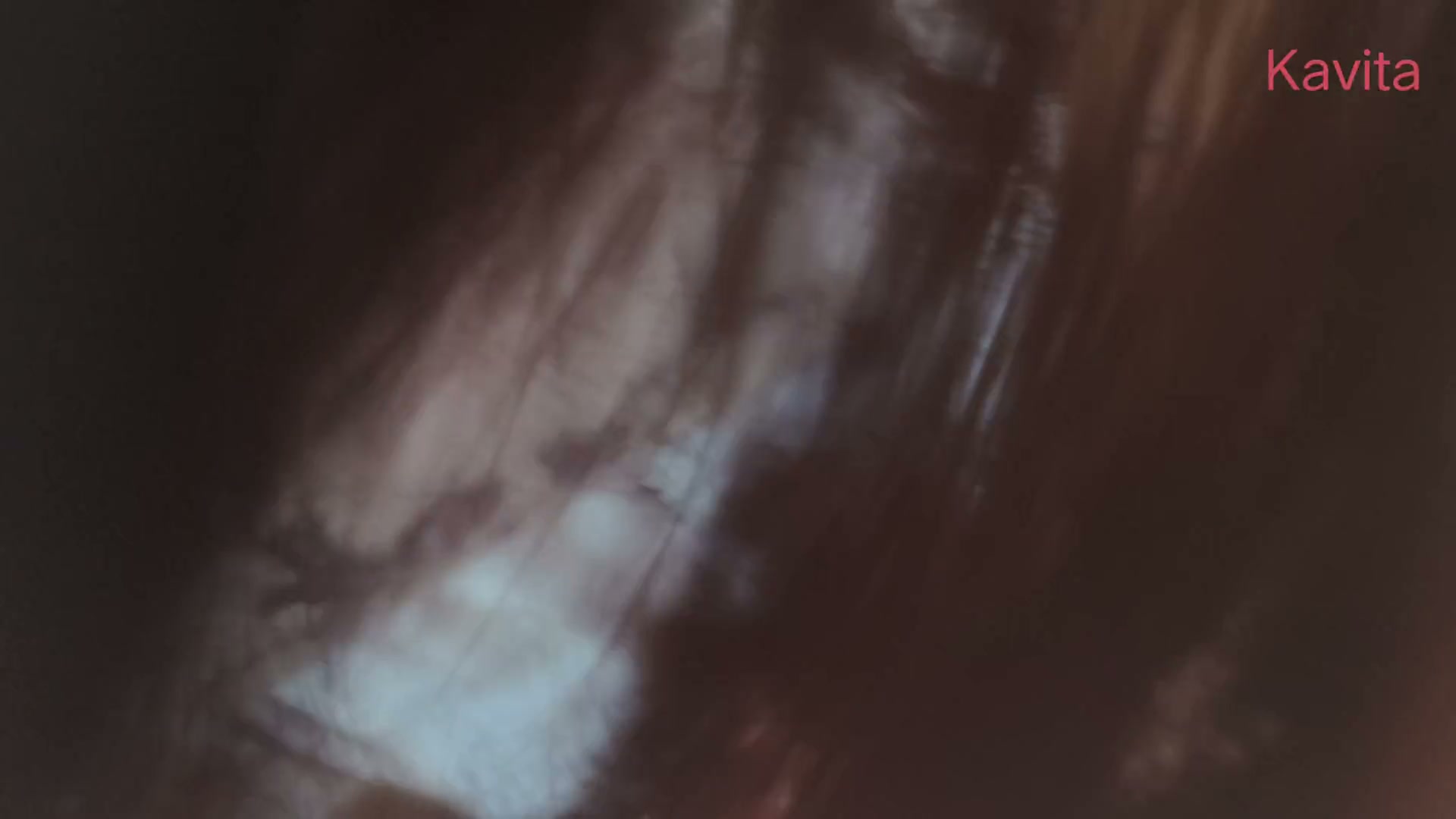 Frame 2