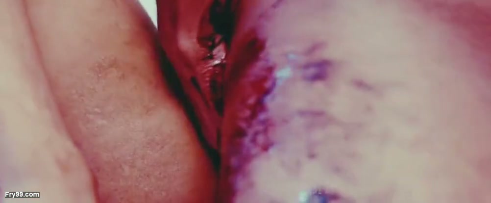 Frame 7