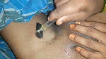 XXX Video of Hair Removal