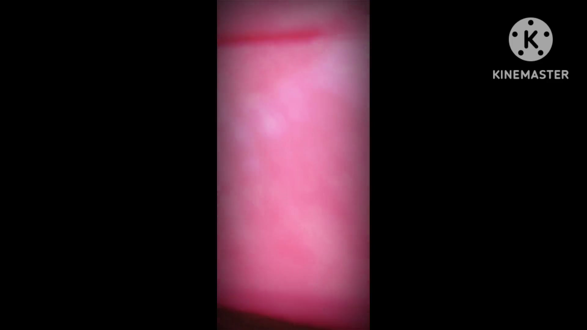 Frame 6