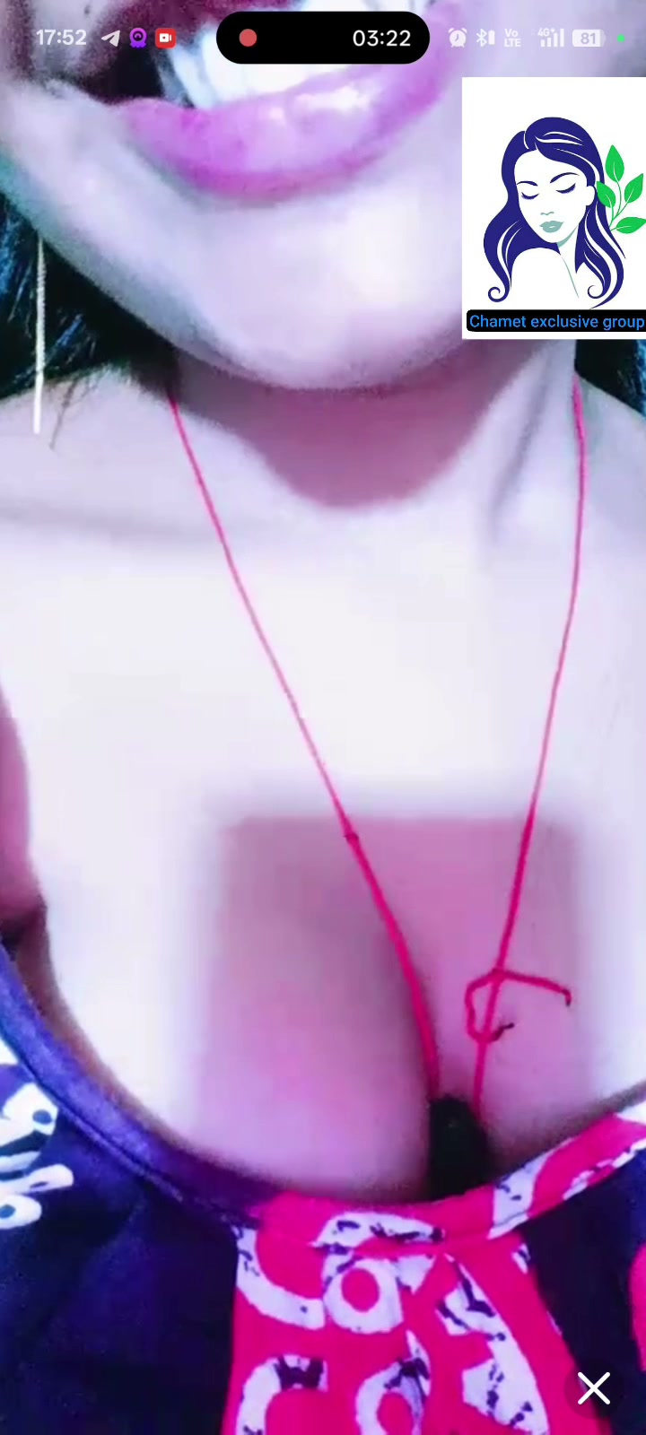 Frame 6