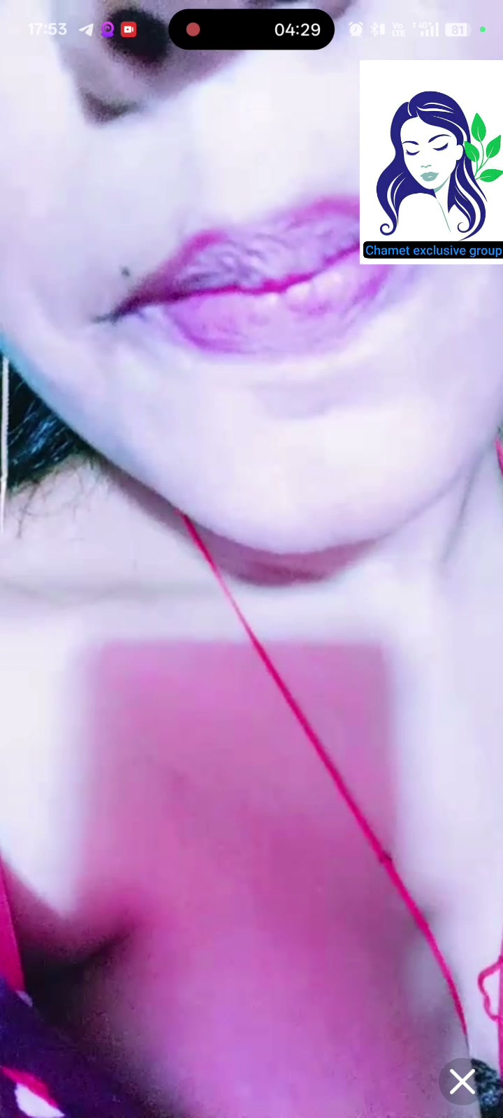Frame 8