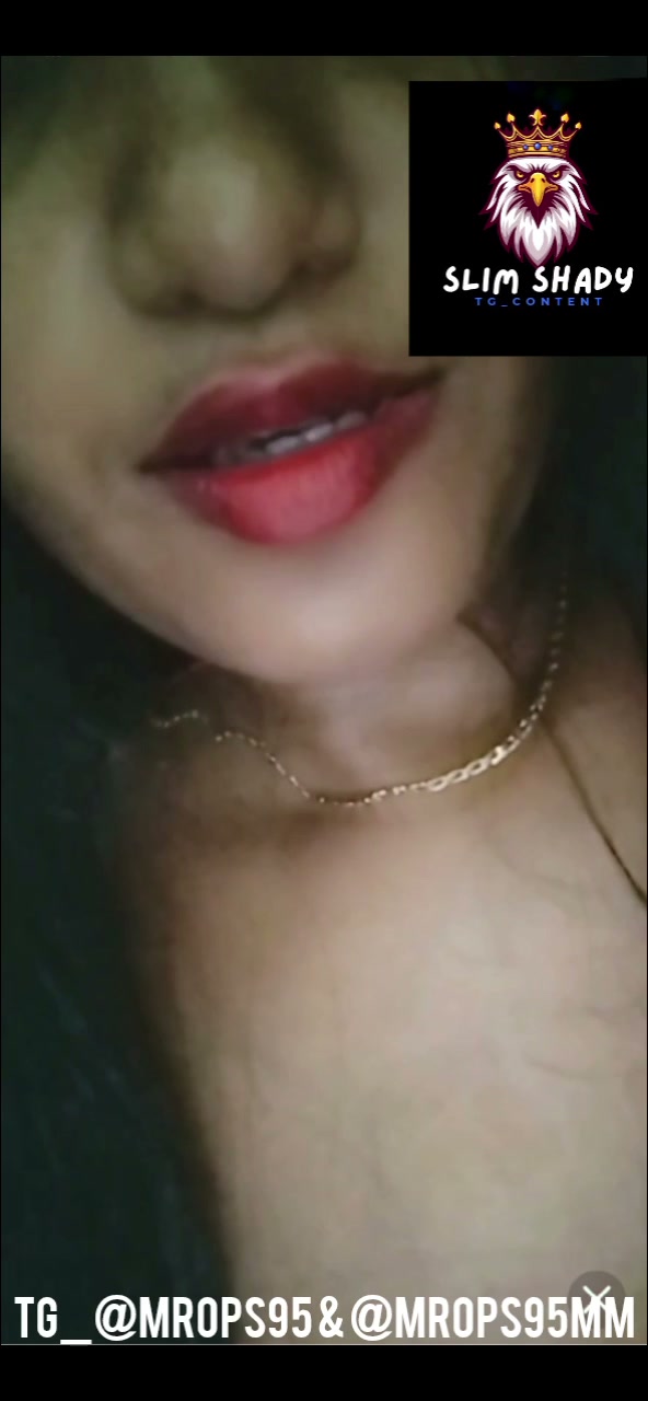 Frame 10