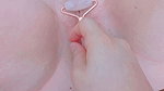roller over the closed shell to dilate and penetrate it