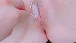 roller over the closed shell to dilate and penetrate it
