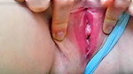 swollen and irritated pussy opening