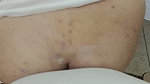 Indian Nurse Big Ass Anal by Doctor