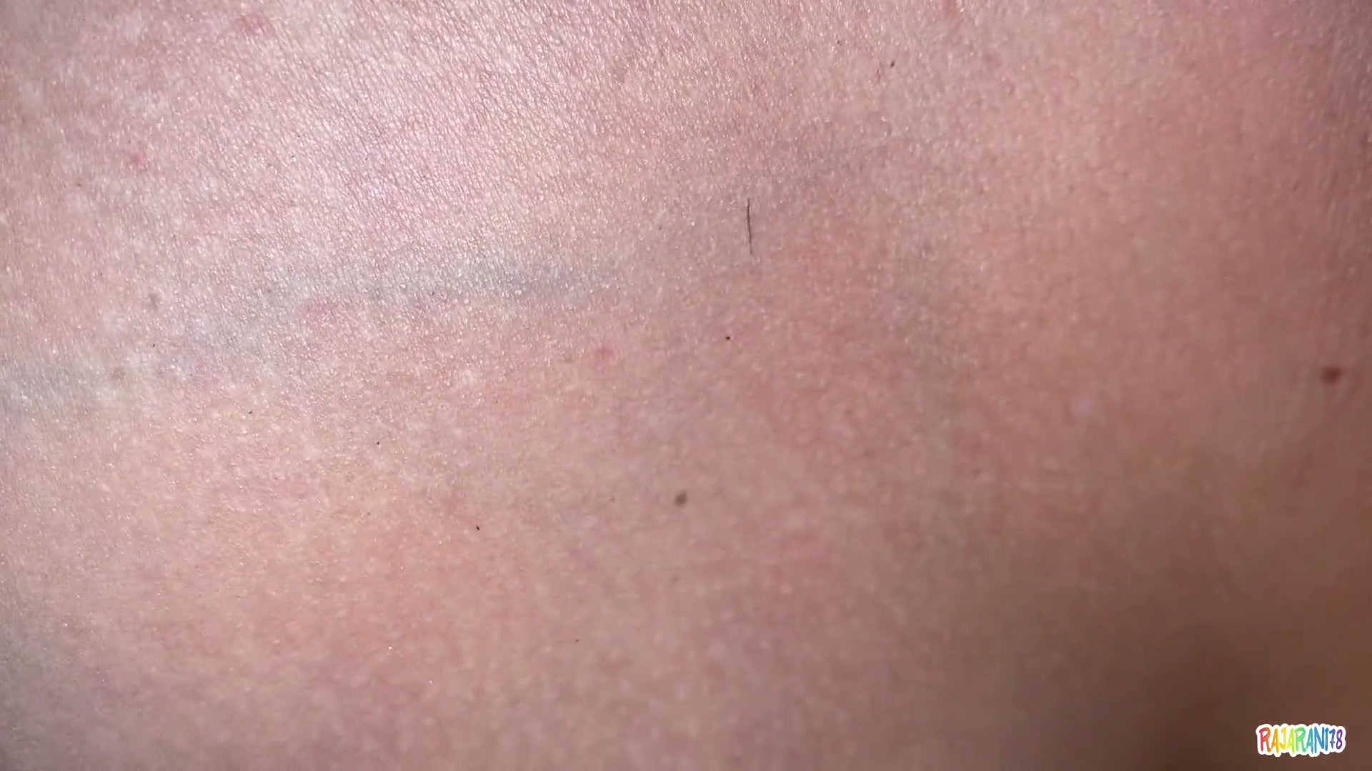 Frame 1
