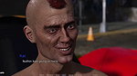Teb 20 Nursing Care Goes Wrong – Kathryn’s Face Gets Creamed and Nearly Ass-fuK