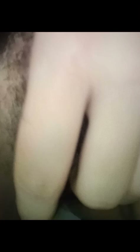 Frame 6