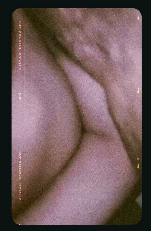 Frame 4