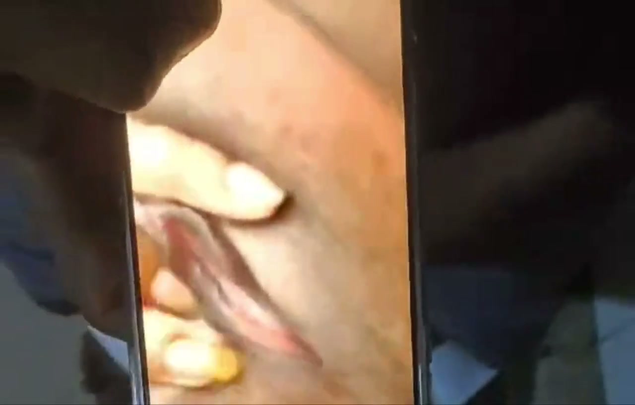 Frame 6