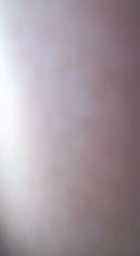 Frame 7