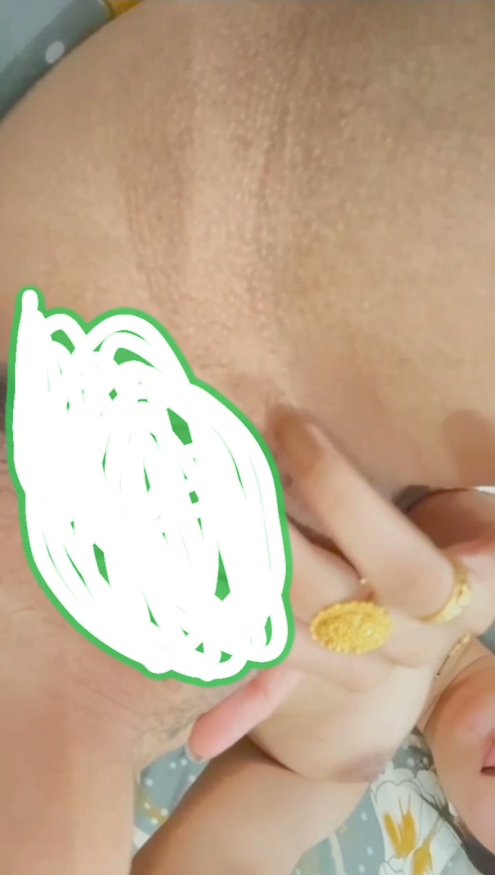 Frame 6