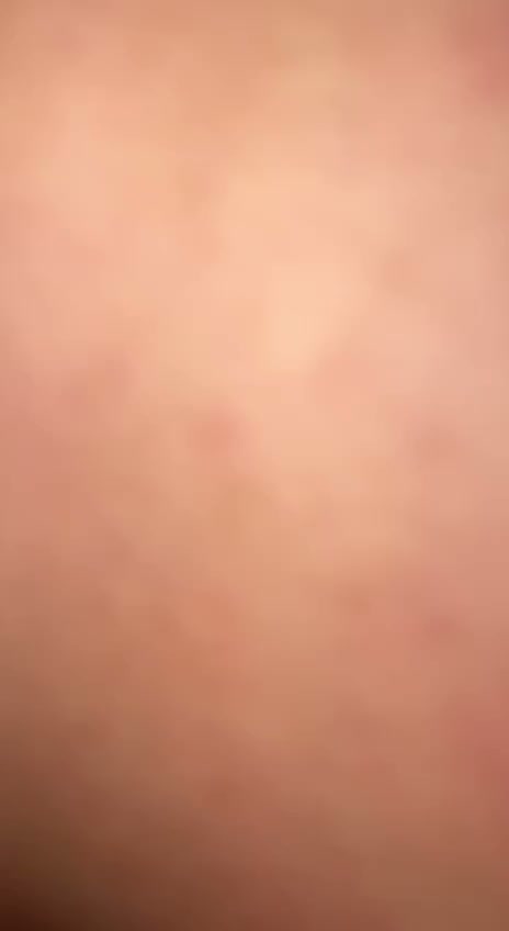 Frame 5