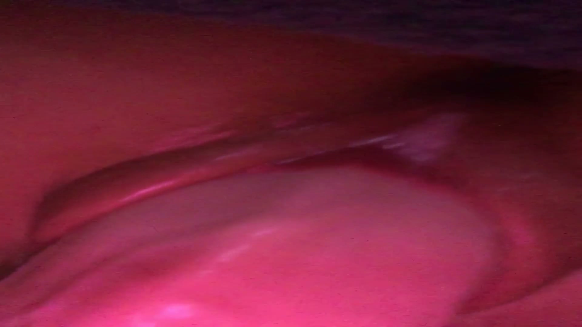 Frame 4