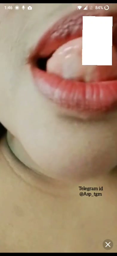 Frame 6