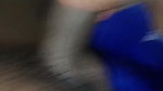 Completely removed in the mouth