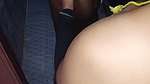 If My Girlfriend Removes Hair From My Penis and Has Sexual Intercourse with Me…