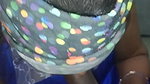 Sister-in-law’s burst in the mouth