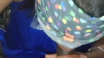 Sister-in-law’s burst in the mouth