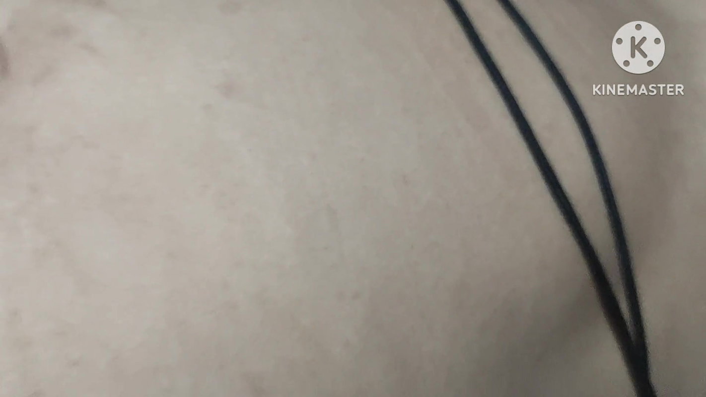 Fat Boobs