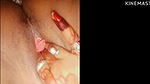 Indian desi chut ko vibrator and lund se choda