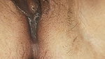 Vagina closeup