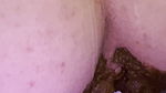 letsplay329 Messy shit running down my legs and filling my white thong