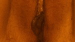Sister-in-law’s rash itching mitigated