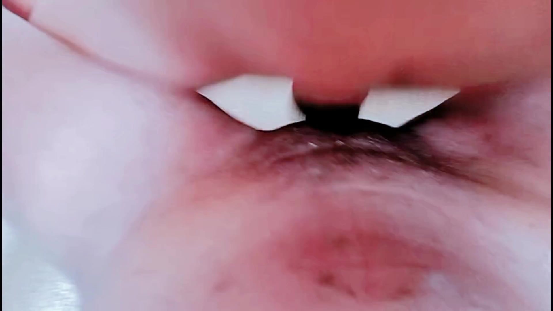 Frame 10