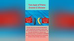 About the Male Penis Tyeps of Penis