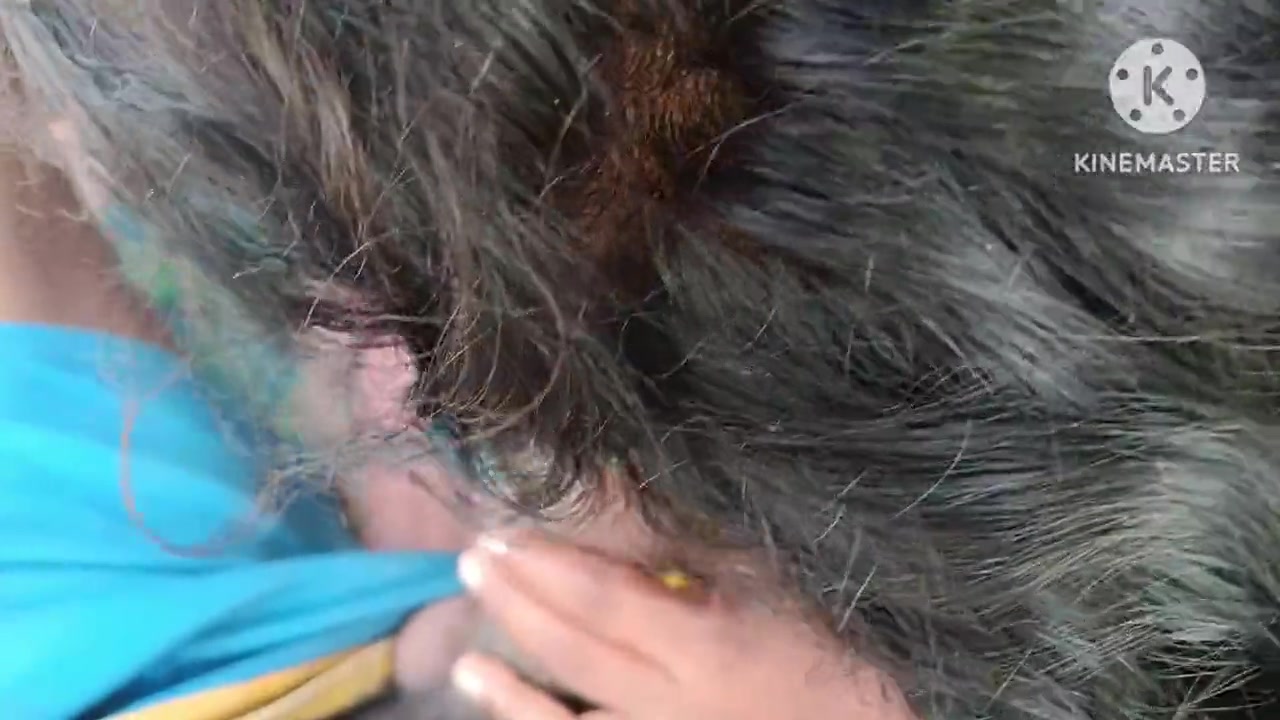 Frame 10