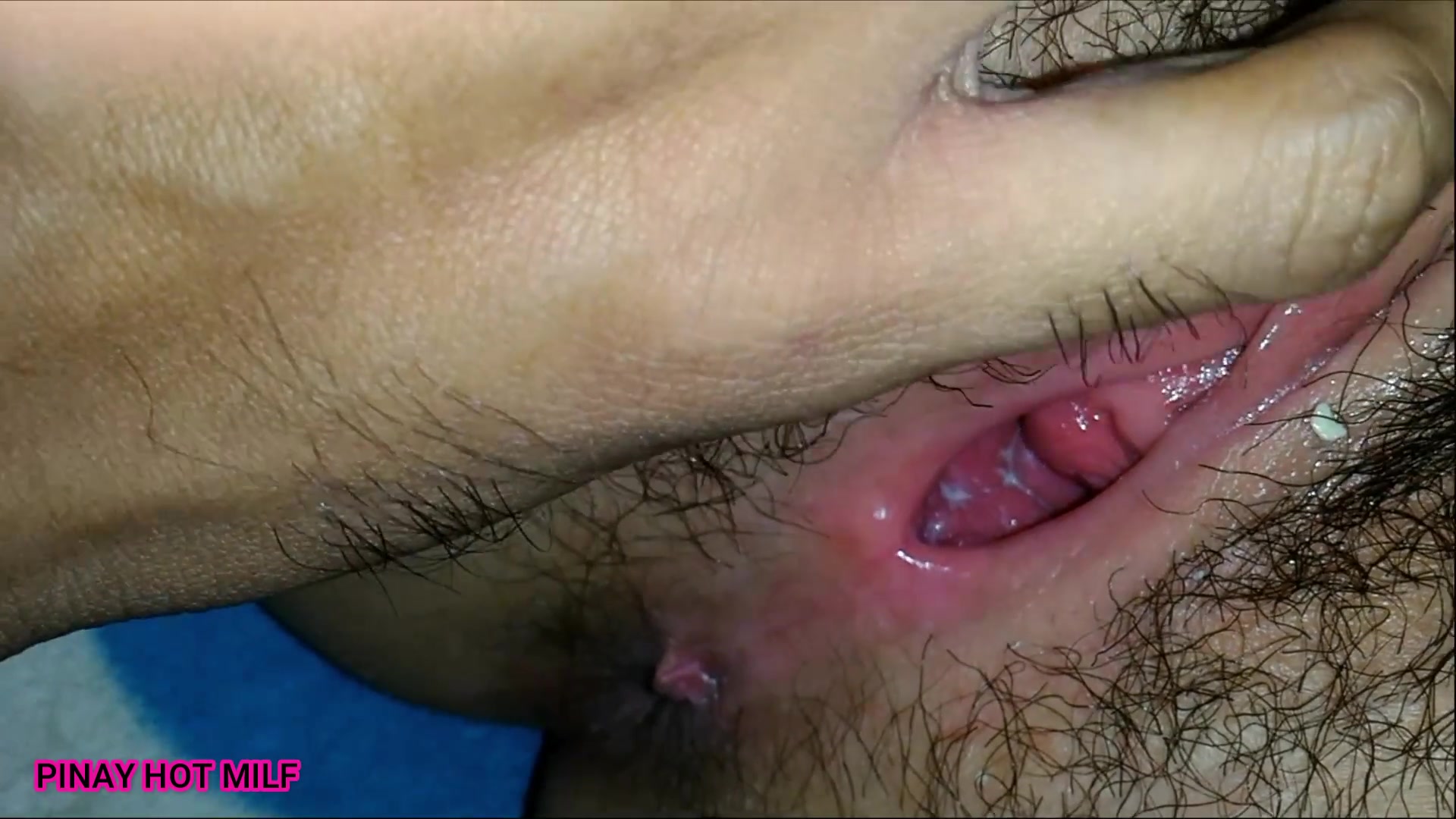 Frame 10