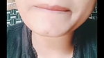 dimpl