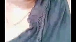 dimpl