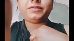 dimpl
