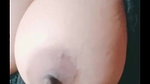 dimpl