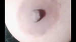 dimpl