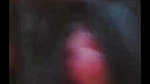 me dustu 2
