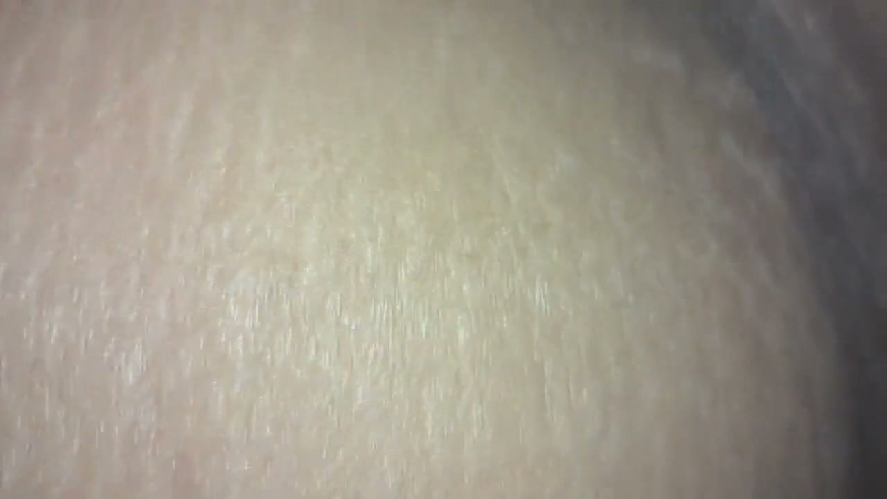 Frame 2