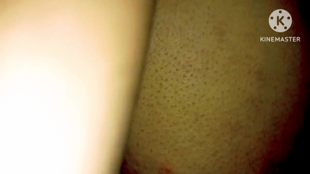 Frame 10