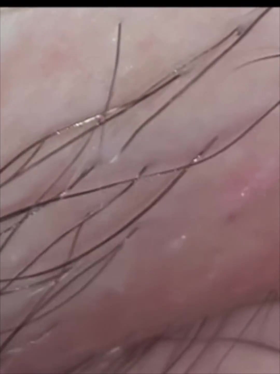Frame 10