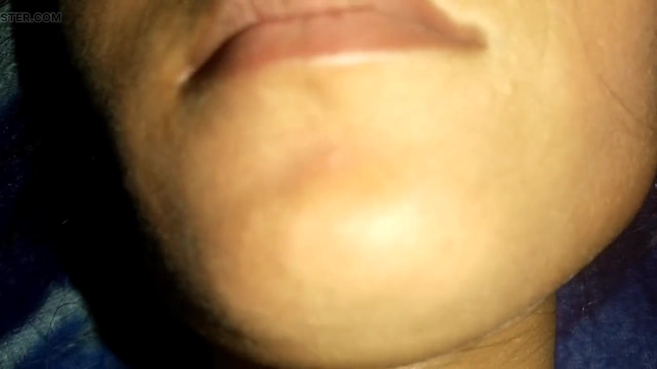 Frame 6